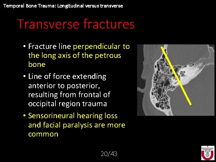 Radiographic Classification Of Temporal Bone Fracture - vrogue.co