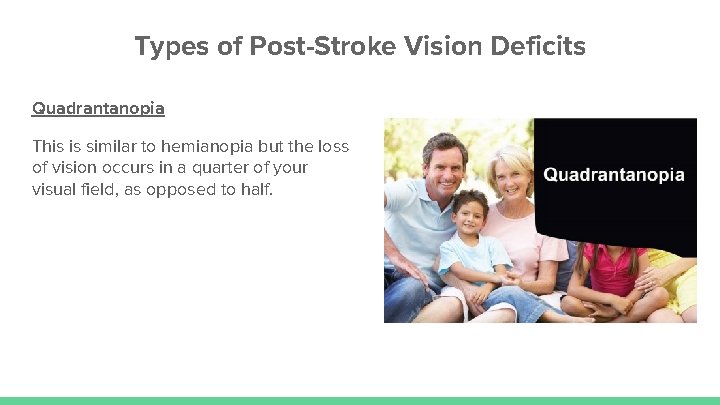 Types of Post-Stroke Vision Deficits Quadrantanopia This is similar to hemianopia but the loss Types of Post-Stroke Vision Deficits Quadrantanopia This is similar to hemianopia but the loss