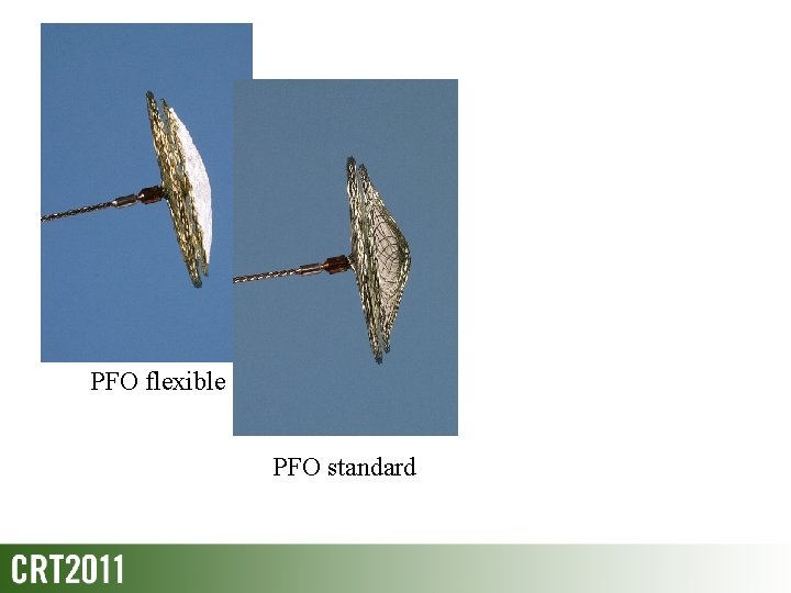 PFO flexible PFO standard 