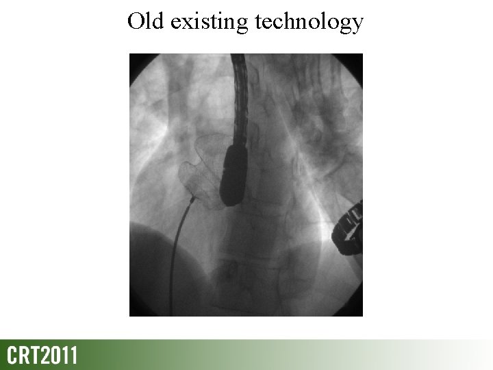 Old existing technology 