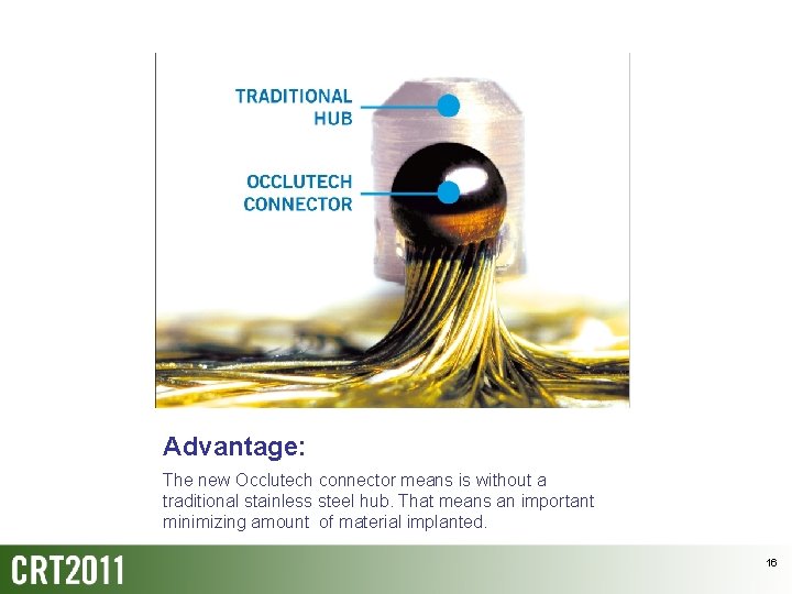 Advantage: The new Occlutech connector means is without a traditional stainless steel hub. That