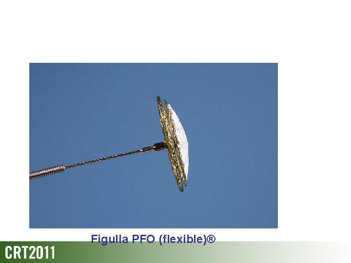 Figulla PFO (flexible)® 