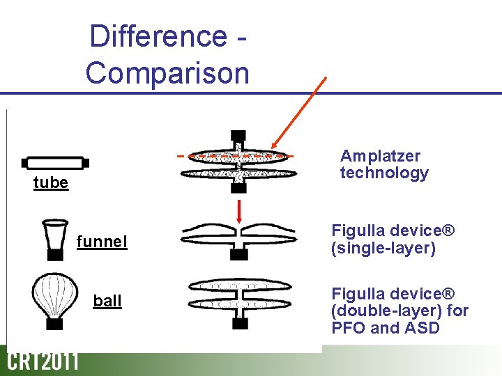 Difference Comparison Amplatzer technology tube funnel ball Figulla device® (single-layer) Figulla device® (double-layer) for