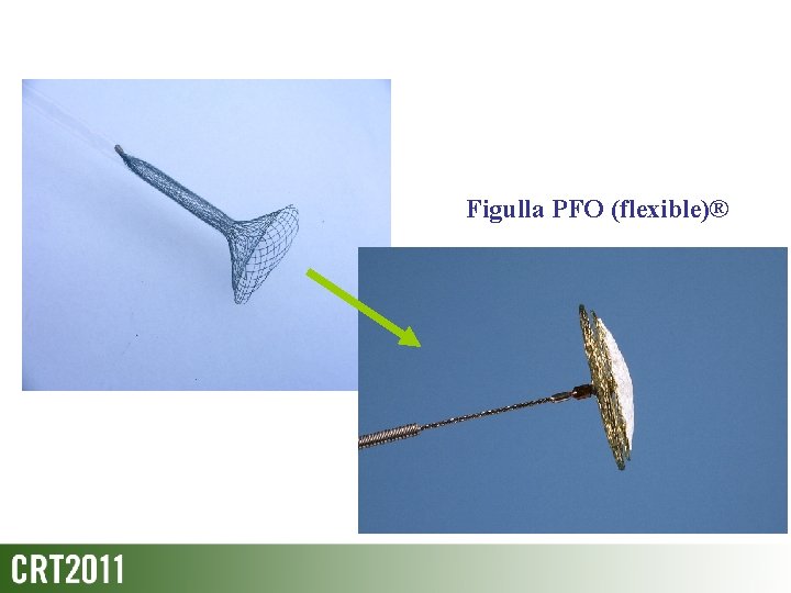Figulla PFO (flexible)® 