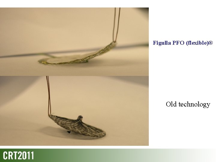 Figulla PFO (flexible)® Old technology 