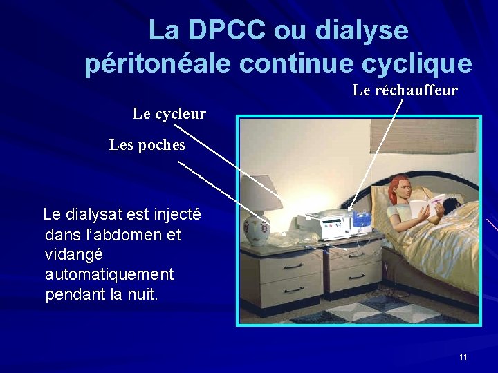 La DPCC ou dialyse péritonéale continue cyclique Le réchauffeur Le cycleur Les poches Le