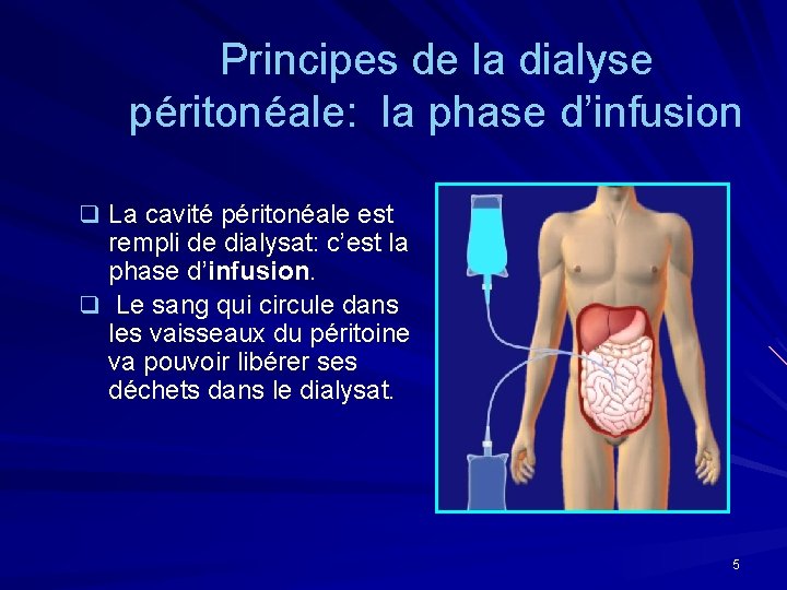Principes de la dialyse péritonéale: la phase d’infusion q La cavité péritonéale est rempli