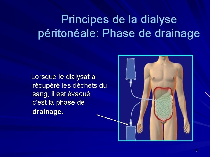 Principes de la dialyse péritonéale: Phase de drainage Lorsque le dialysat a récupéré les