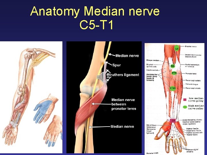 Anatomy Median nerve C 5 -T 1 