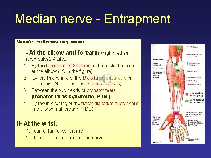 Median nerve - Entrapment Sites of the median nerve compression : I- At the