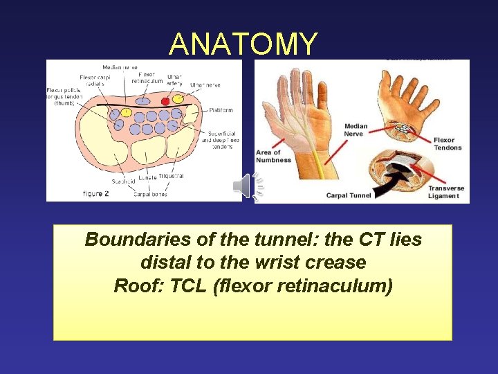 ANATOMY Boundaries of the tunnel: the CT lies distal to the wrist crease Roof: