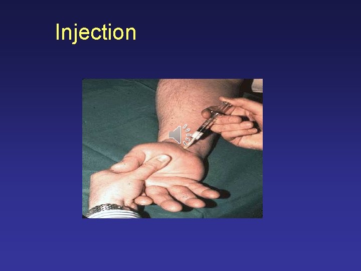 Injection 