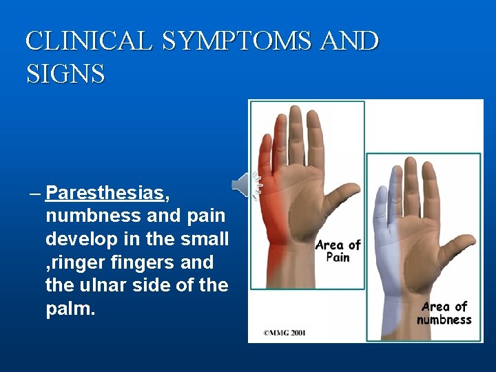 CLINICAL SYMPTOMS AND SIGNS – Paresthesias, numbness and pain develop in the small ,