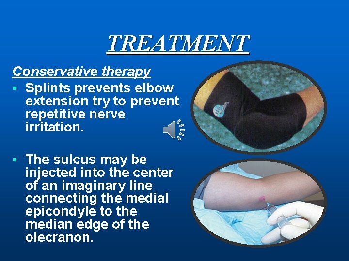 TREATMENT Conservative therapy § Splints prevents elbow extension try to prevent repetitive nerve irritation.