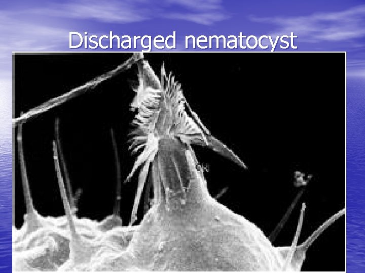 Discharged nematocyst 