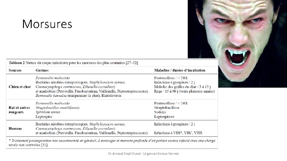 Morsures Dr Arnaud Depil Duval - Urgences Evreux Vernon 