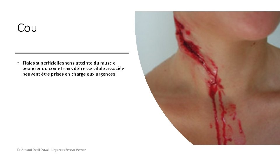 Cou • Plaies superficielles sans atteinte du muscle peaucier du cou et sans détresse