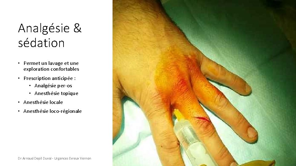 Analgésie & sédation • Permet un lavage et une exploration confortables • Prescription anticipée