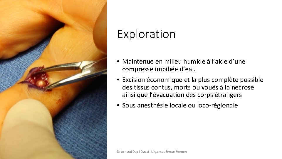 Exploration • Maintenue en milieu humide à l’aide d’une compresse imbibée d’eau • Excision