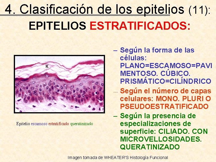 4. Clasificación de los epitelios (11): EPITELIOS ESTRATIFICADOS: Epitelio escamoso estratificado queratinizado – Según