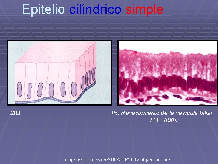 Epitelio cilíndrico simple MH IH: Revestimiento de la vesícula biliar, H-E, 800 x Imágenes