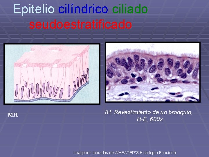 Epitelio cilíndrico ciliado seudoestratificado MH IH: Revestimiento de un bronquio, H-E, 600 x Imágenes