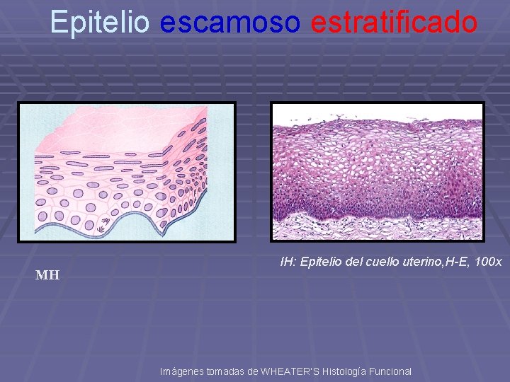 Epitelio escamoso estratificado MH IH: Epitelio del cuello uterino, H-E, 100 x Imágenes tomadas