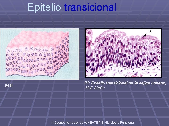 Epitelio transicional MH IH: Epitelio transicional de la vejiga urinaria, H-E 320 X: Imágenes