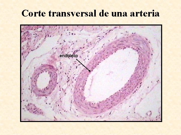 Corte transversal de una arteria endotelio 