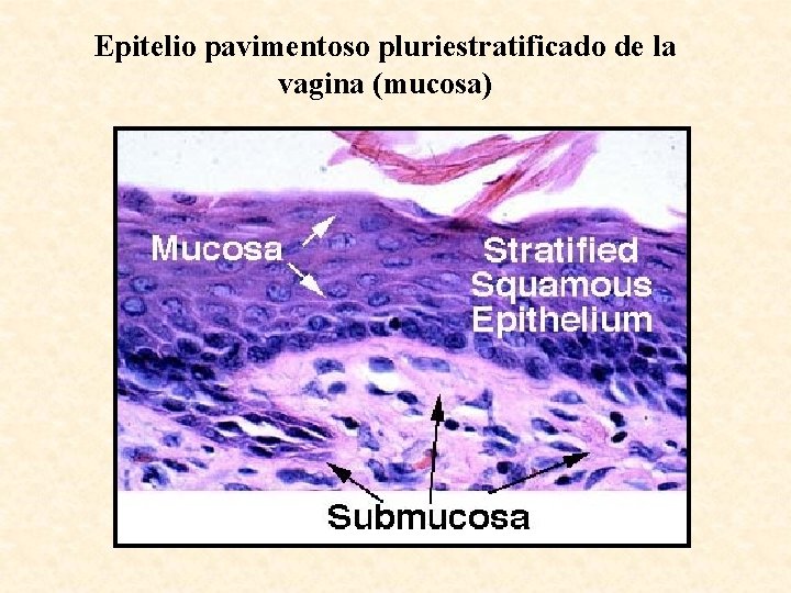 Epitelio pavimentoso pluriestratificado de la vagina (mucosa) 