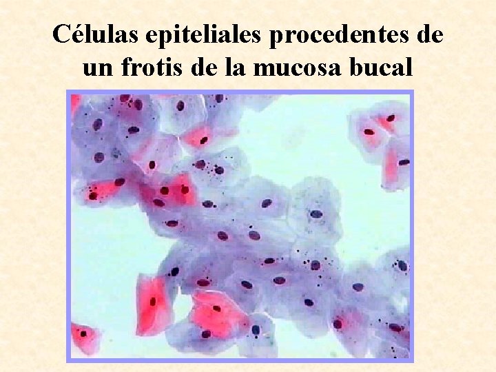 Células epiteliales procedentes de un frotis de la mucosa bucal 