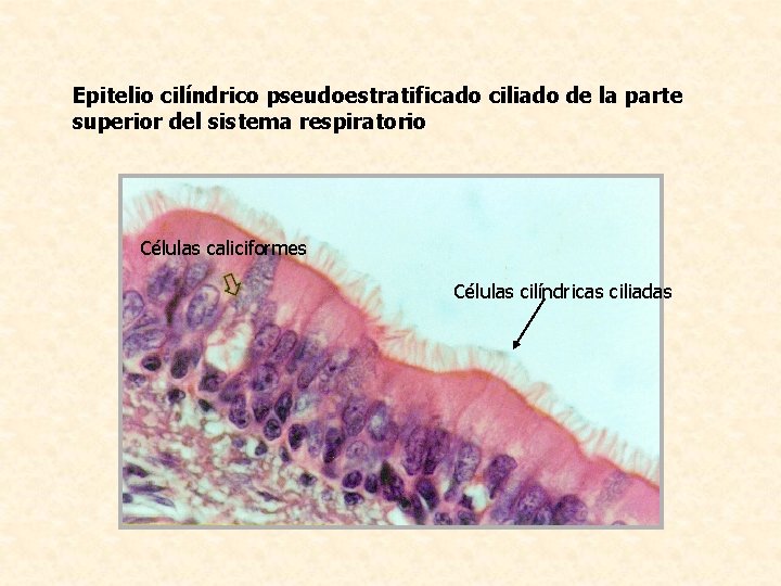 Epitelio cilíndrico pseudoestratificado ciliado de la parte superior del sistema respiratorio Células caliciformes Células