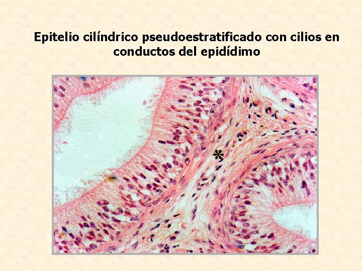 Epitelio cilíndrico pseudoestratificado con cilios en conductos del epidídimo 