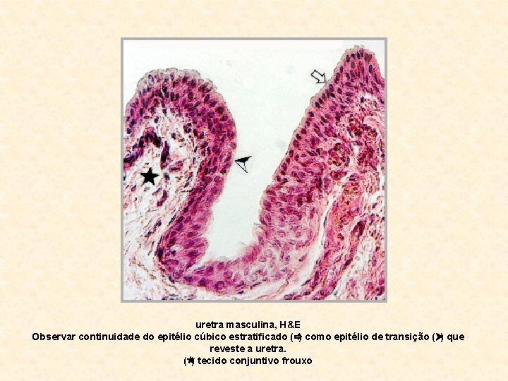 uretra masculina, H&E Observar continuidade do epitélio cúbico estratificado (ð) como epitélio de transição