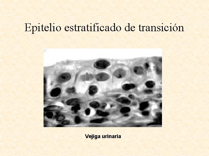 Epitelio estratificado de transición Vejiga urinaria 