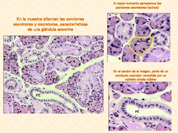 A mayor aumento apreciamos las porciones secretoras (acinos) En la muestra alternan las porciones