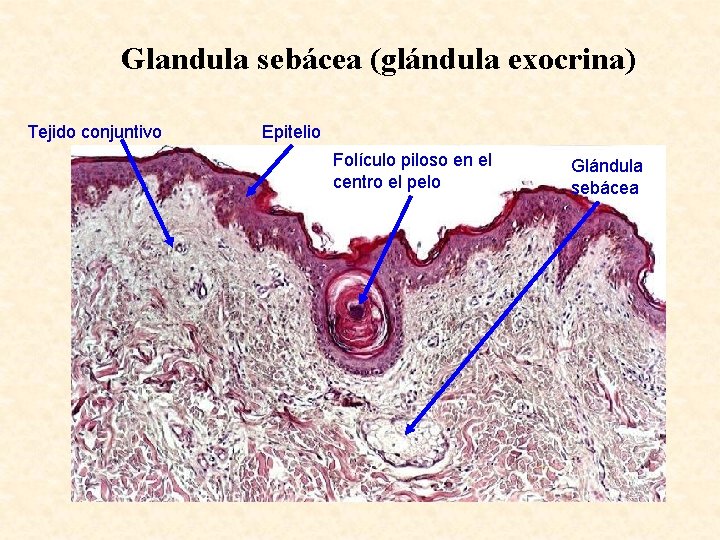 Glandula sebácea (glándula exocrina) Tejido conjuntivo Epitelio Folículo piloso en el centro el pelo