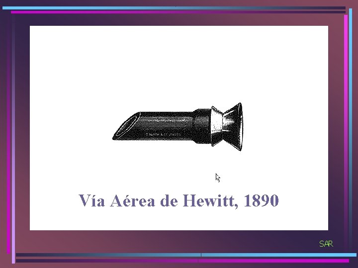 Vía Aérea de Hewitt, 1890 SAR 