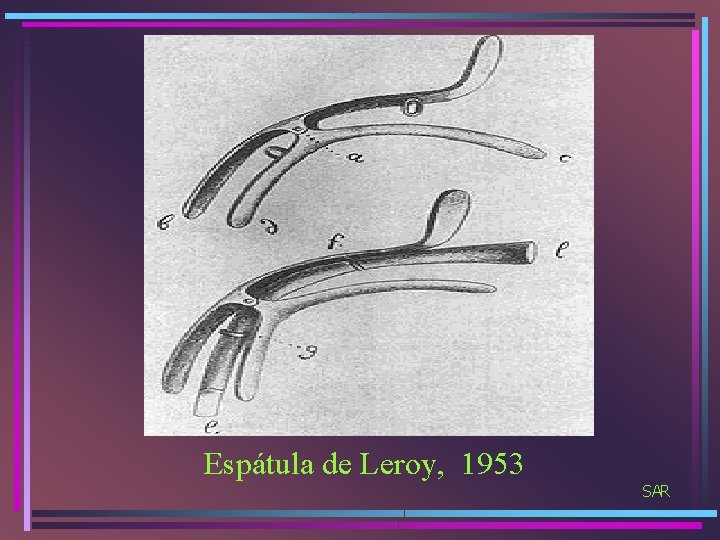 Espátula de Leroy, 1953 SAR 