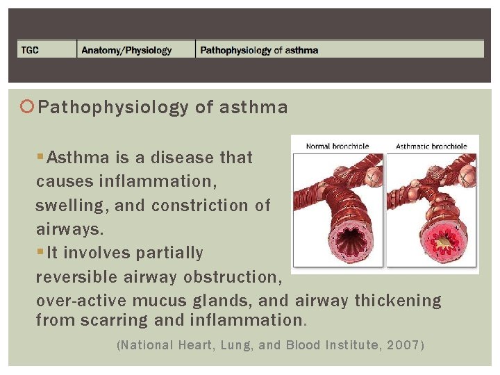  Pathophysiology of asthma § Asthma is a disease that causes inflammation, swelling, and