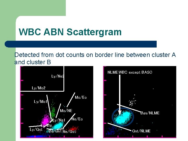 WBC ABN Scattergram Detected from dot counts on border line between cluster A and