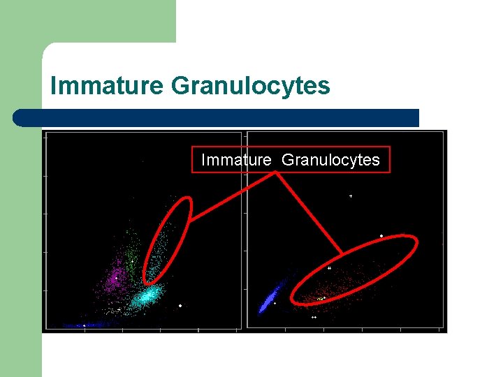 Immature Granulocytes 