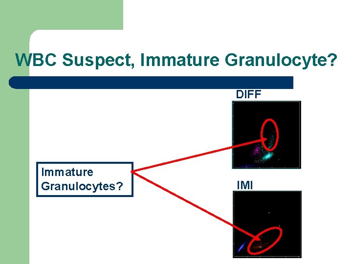 WBC Suspect, Immature Granulocyte? DIFF Immature Granulocytes? IMI 