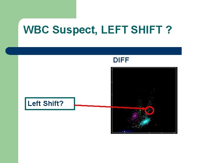 WBC Suspect, LEFT SHIFT ? DIFF Left Shift? 