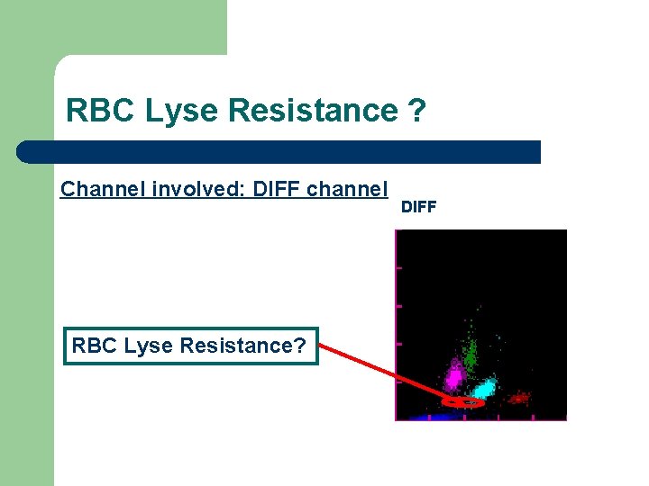 RBC Lyse Resistance ? Channel involved: DIFF channel RBC Lyse Resistance? DIFF 