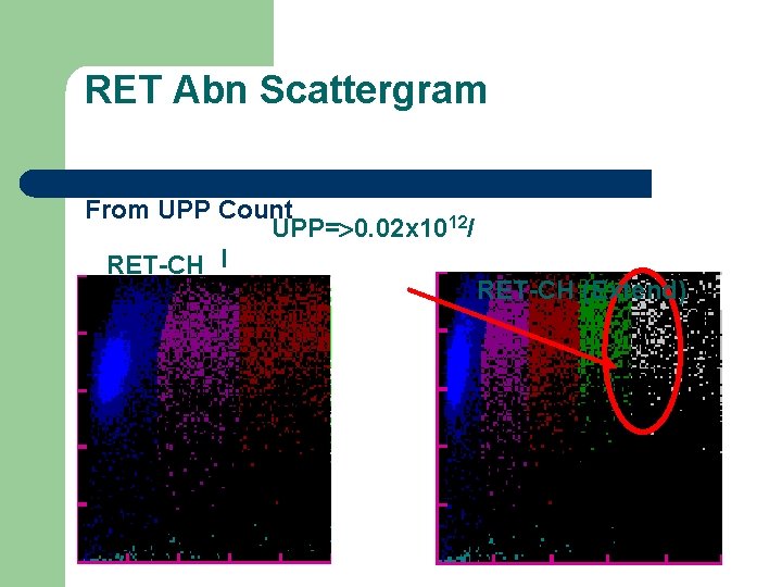 RET Abn Scattergram From UPP Count UPP= 0. 02 x 1012/ RET-CH l RET-CH