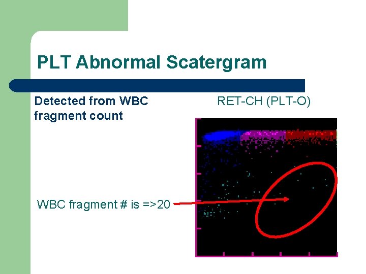 PLT Abnormal Scatergram Detected from WBC fragment count WBC fragment # is =>20 RET-CH