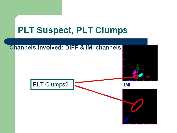 PLT Suspect, PLT Clumps Channels involved: DIFF & IMI channels PLT Clumps? DIFF IMI