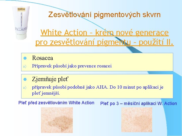 Zesvětlování pigmentových skvrn White Action – krém nové generace pro zesvětlování pigmentu – použití