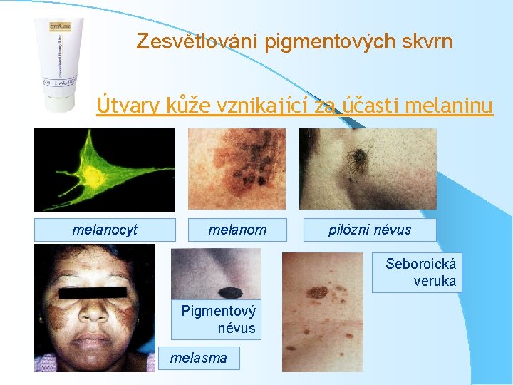 Zesvětlování pigmentových skvrn Útvary kůže vznikající za účasti melaninu melanocyt melanom pilózní névus Seboroická